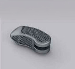 Artrodesis/fusión vertebral. 18 artrodesis-vertebral-o-fusion-vertebral-1564949355-1564950862