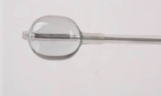 b4ab160a 31cf 4675 8ed1 25c37ef0bce1.1522167022 - Cifoplastia con balón. Tratamiento de las fracturas vertebrales osteoporoticas.