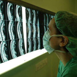 img 1094.1529407249 - Información para el paciente: Endoscopia y Cirugía Mínimamente invasiva de Columna