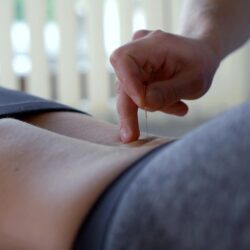 portada acupuntura.1620156632 - ¿Puede la acupuntura mejorar el dolor de espalda?