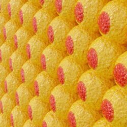 portada lipomatosis 1.1645074225 - Lipomatosis epidural