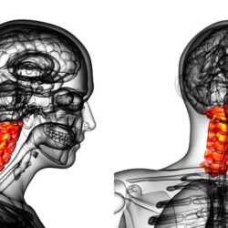 portada operacion de cervicales.1617718942 - Operación de cervicales