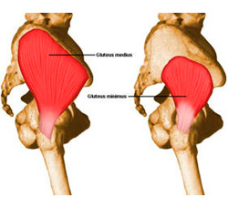 Sindrome del músculo gluteo medio 23 Síndrome del Glúteo Medio