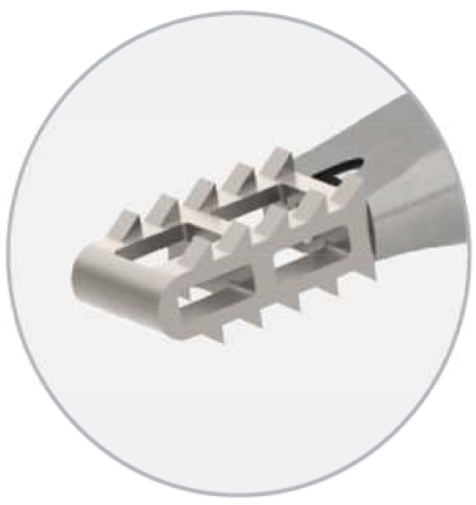 Fusi&oacute;n Cervical