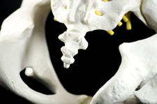 cómo tratar del dolor de coxis