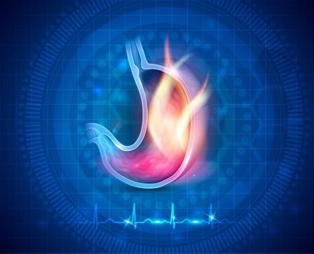 &Uacute;lcera de Est&oacute;mago