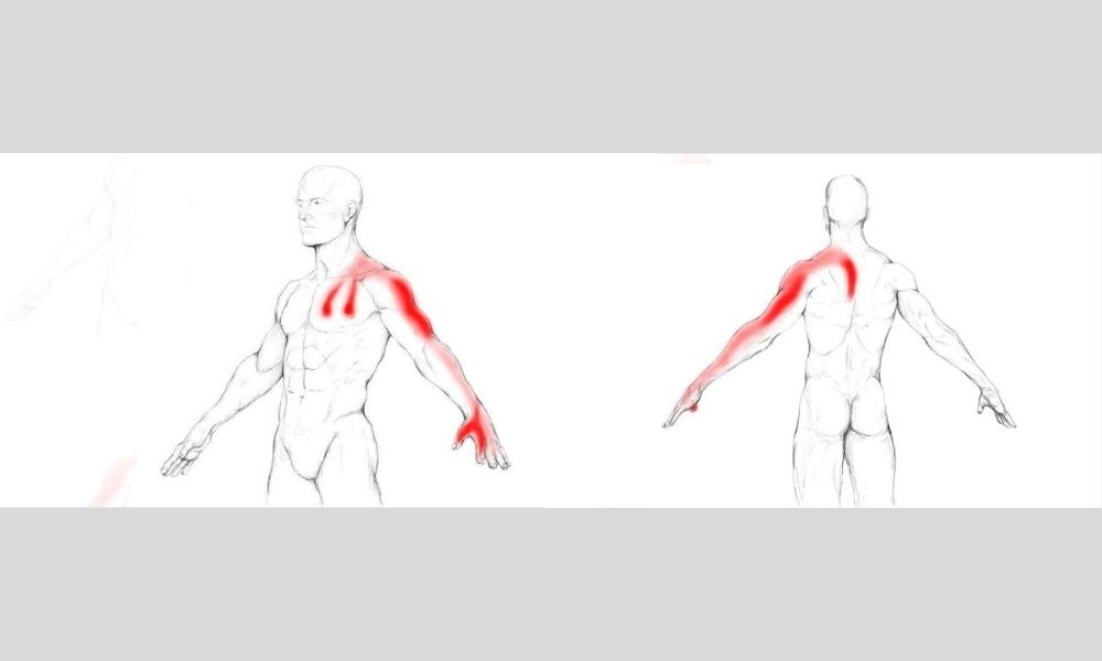 Musculos escalenos. Cómo afectan al dolor cervical. 3 Síntomas del Síndrome del Desfiladero Torácico.