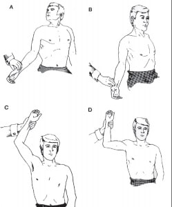 Musculos escalenos. Cómo afectan al dolor cervical. 4 Diagnóstico del Síndrome del Desfiladero Torácico.