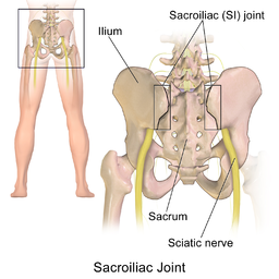 Fusión Sacroilíaca. Tratamiento mínimamente invasivo de la sacroileitis. 2 Articulación sacroilíaca